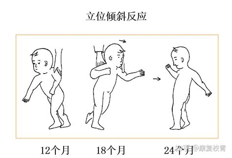 对面立位